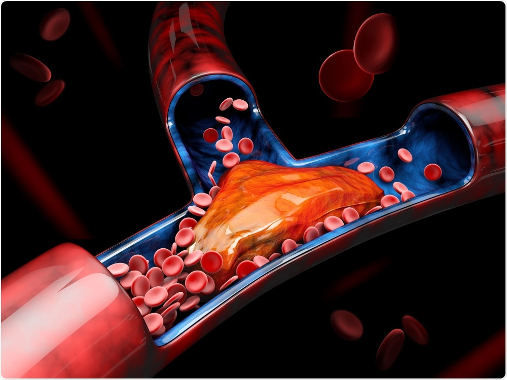 قابلیت انعقاد پذیری بالا و کووید۱۹